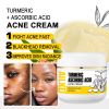 AILKE Organic Turmeric Skin Care Range, Whiten, Remove Acne, Clean Stains, Exfoliation, Even Skin Tone, Improve Dull Skin